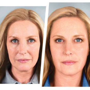 effet de rajeunissement des yeux